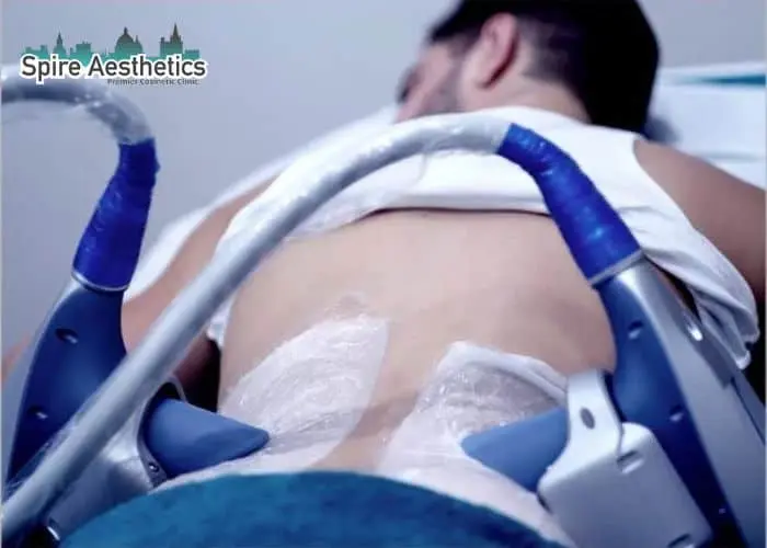 Man having fat freezing treatment done on love handles before a competitions Hinkley to create a sculpted look.