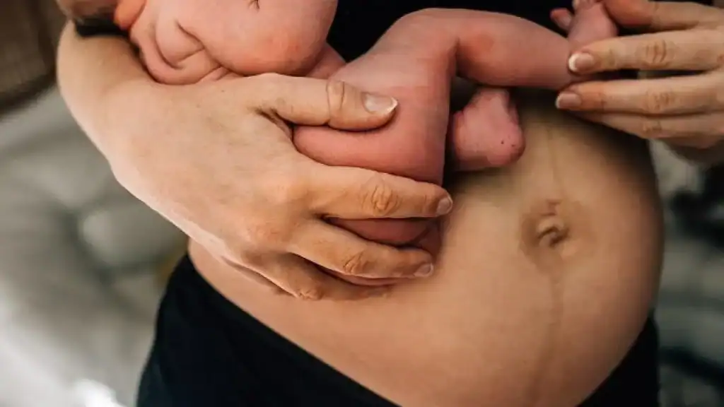 Why Is My Stomach Still Big After Pregnancy Hinkley?